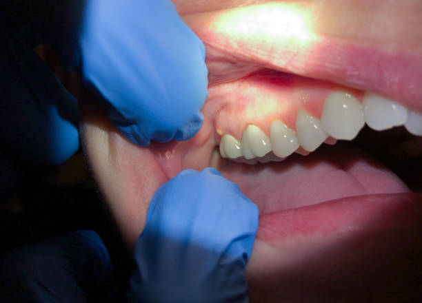Best Emergency TMJ Treatment in Butler, GA